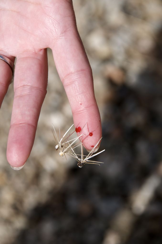 Barbs deeply embedded in the skin!/